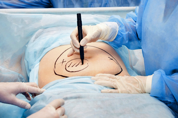 Medical Surgery Injuries in Hartford Wrong Incision Surgery Medical Malpractice